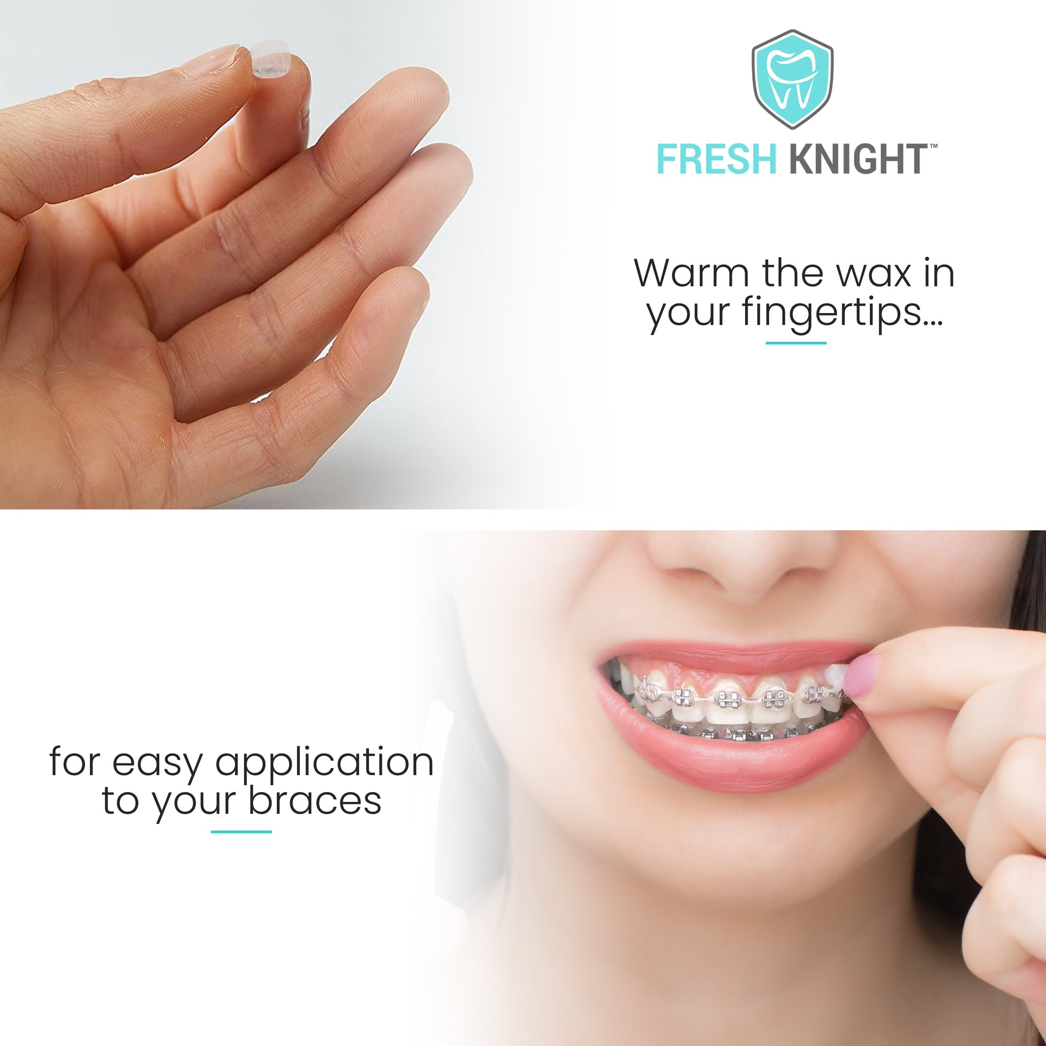 Premium Braces Wax 10 pack with FREE storage case. FreshKnight